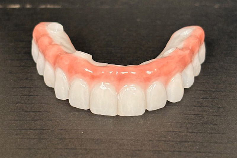 All on 4 Fixed Implant Hybrid Denture in Waterbury